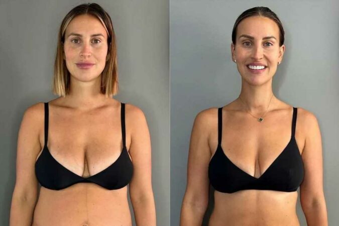 Ferne-McCann-shows-off-incredible-weight-loss-in-before-and-after-snaps-two-months-after-giving-birth-The-Sun.jpg