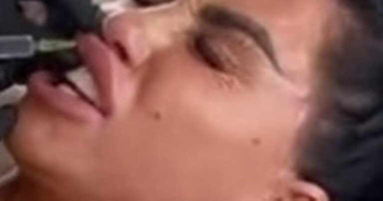 Katie-Price-weeps-in-pain-as-she-gets-lip-fillers-dissolved-before-showing-off-results.jpg