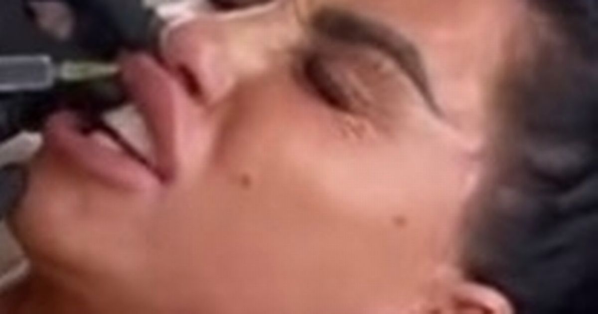 Katie-Price-weeps-in-pain-as-she-gets-lip-fillers-dissolved-before-showing-off-results.jpg