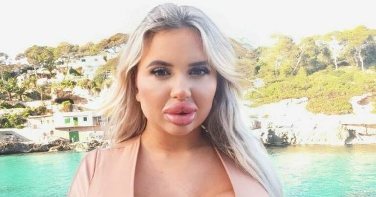 Meet-people-who-risked-death-for-perfect-bums-–-with-hellishly-painful-surgery.jpg