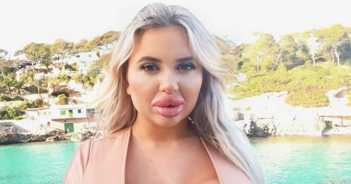 Meet-people-who-risked-death-for-perfect-bums-–-with-hellishly-painful-surgery.jpg