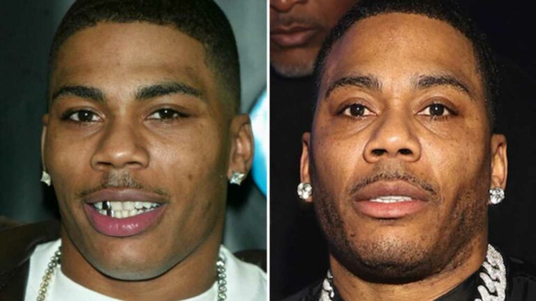 Nelly-Good-Genes-Or-Good-Docs.jpg
