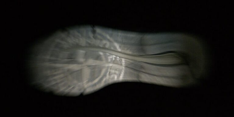 Stone-Island-Teases-New-Balance-991v2-Collab.jpg