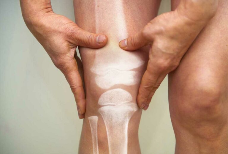 The-5-early-bone-cancer-symptoms-as-76-of-cases-are-misdiagnosed-The-Sun.jpg