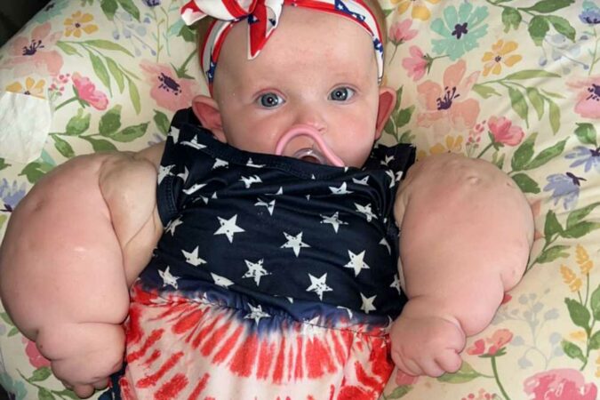 Tot-dubbed-‘baby-Hulk-after-being-born-with-ENORMOUS-arms-and-chest-The-Sun.jpg