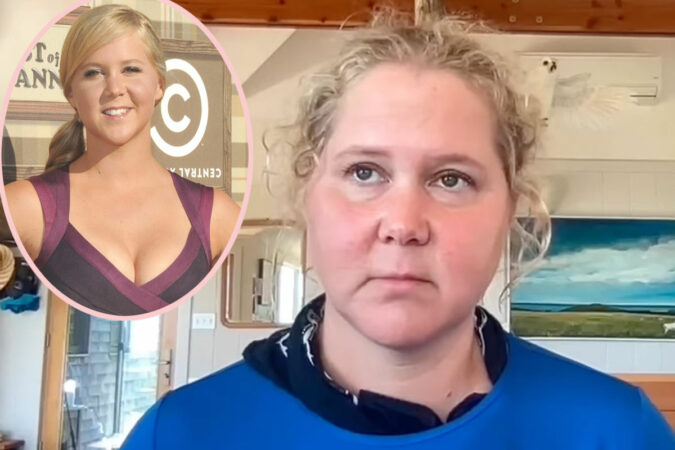 Amy-Schumer-Shares-Shocking-Before-After-Pics-Warning-20-Somethings-That-Life-Is-Coming-.jpg