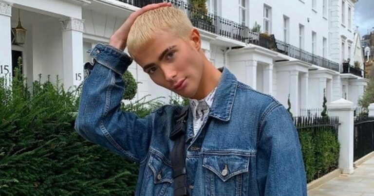 TOWIEs-Joey-Turner-unrecognisable-as-he-shows-off-hair-transplant-results.jpg