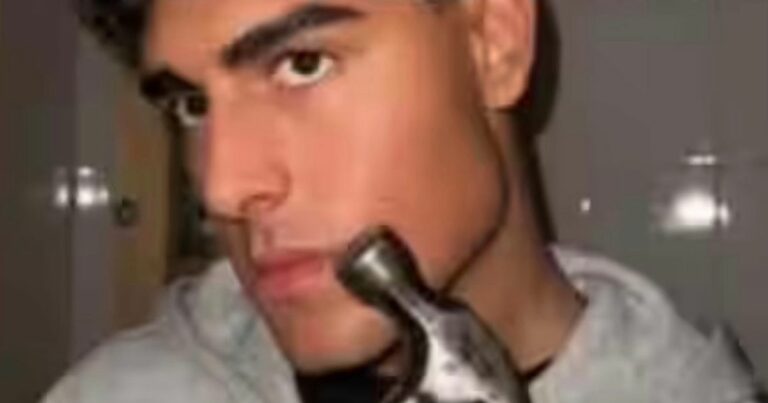 Teens-hit-themselves-with-hammers-to-readjust-face-in-dangerous-new-trend.jpg