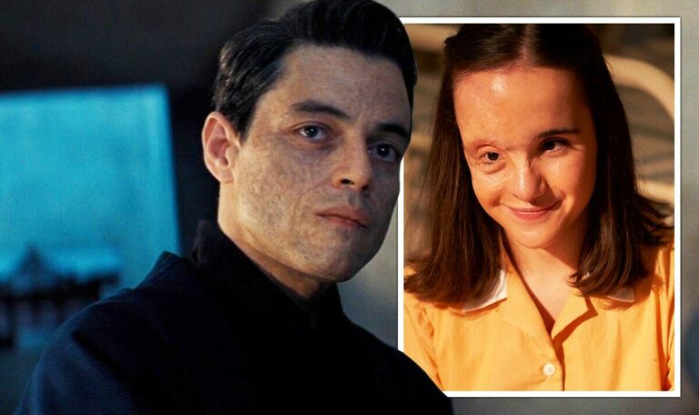 ‘James-Bond-villains-hurt-perceptions-of-visible-differences-says-Sex-Ed-star.jpg