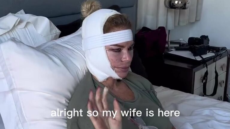 Caroline-Stanburyaposs-husband-driven-to-tears-over-botched-face-lift..jpg
