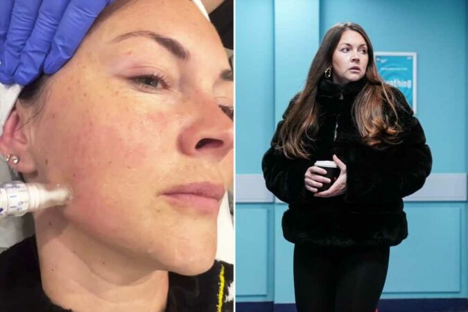 EastEnders-star-Lacey-Turner-shows-off-her-‘real-skin-as-she-goes-make-up-free-for-firming-treatment-The-Sun.jpg