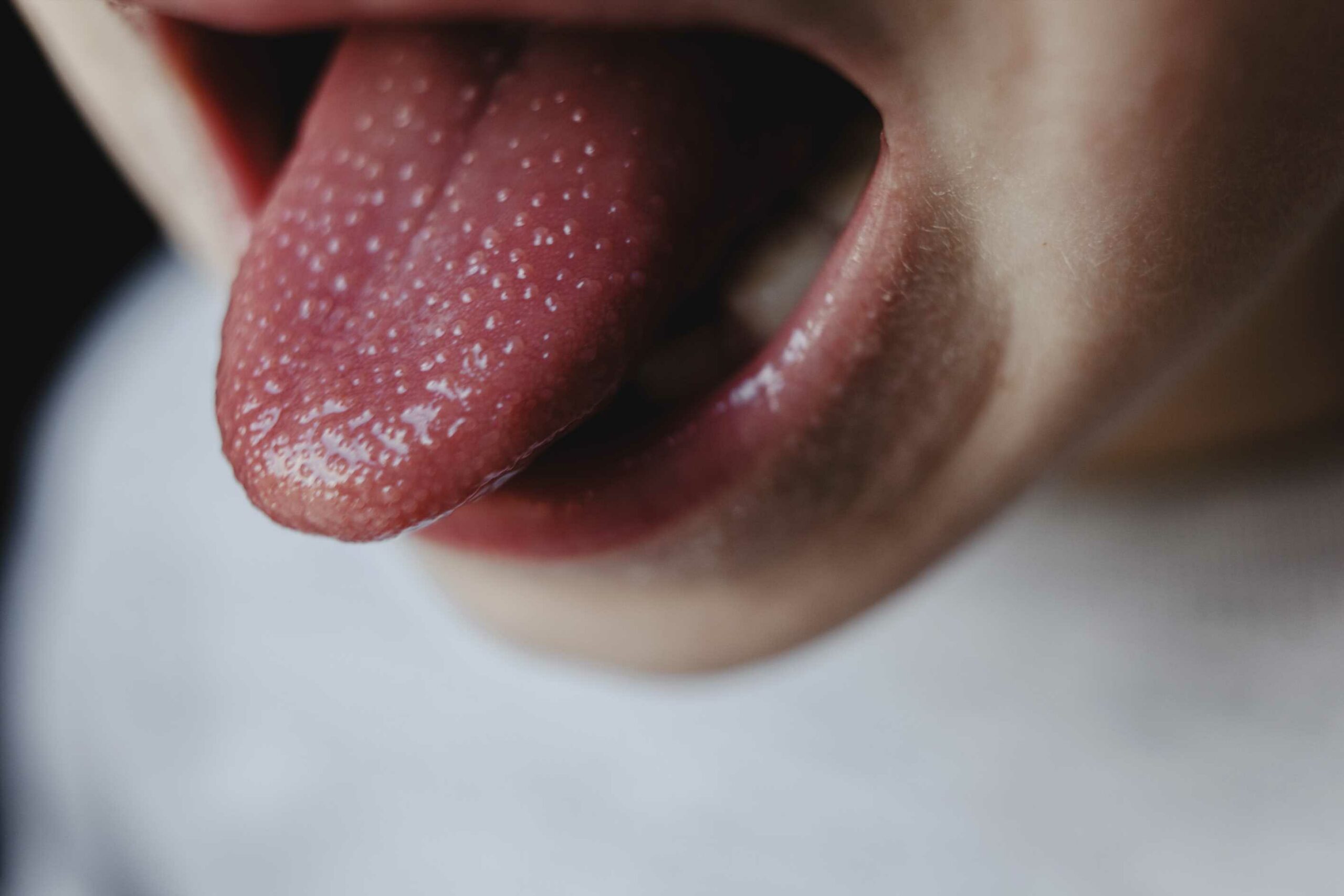 Fears-of-outbreak-grow-as-scarlet-fever-cases-double-in-part-of-the-UK-map-reveals-worst-hit-areas-The-Sun.jpg