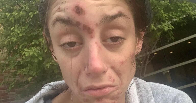 Homeless-woman-who-was-obsessed-with-meth-unrecognisable-after-ditching-drugs.jpg