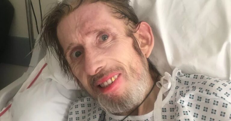 The-Pogues-Shane-MacGowan-tragic-end-of-life-–-health-trouble-to-hospital-dashes.jpg