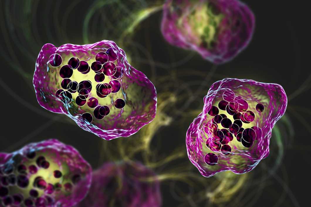 Urgent-measles-warning-as-outbreak-of-deadly-Victorian-disease-declared-in-Wales-after-7-children-fall-ill-The-Sun.jpg