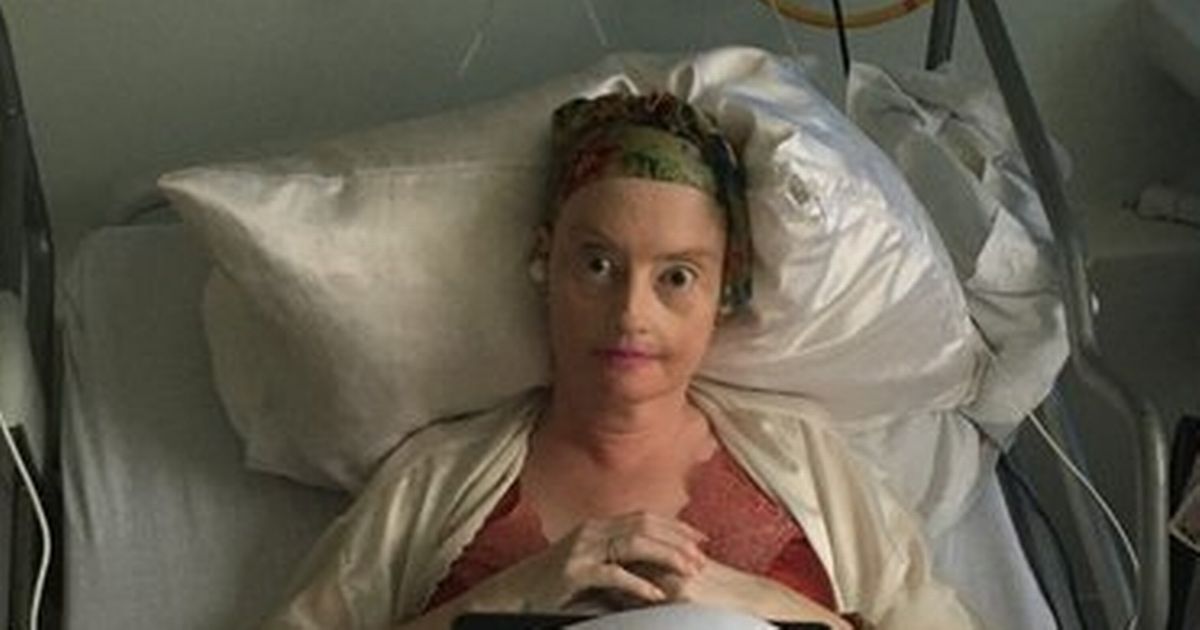 Naked-Attraction-star-leaves-hospital-for-Christmas-after-near-death-incident.jpg