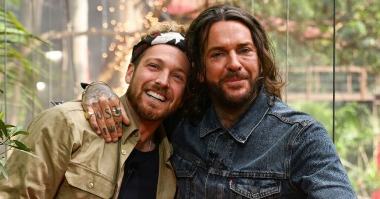 Pete-Wicks-shares-face-problem-as-Im-A-Celeb-fans-floored-by-Botox-and-filler.jpg